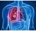 Медикаментозное управление окислительно-восстановительным состоянием организма  при заболеваниях органов дыхания  (часть 4)