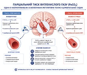 Анестезіологічне забезпечення операцій на верхній кінцівці в положенні «пляжного крісла»: огляд сучасних підходів