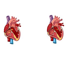 Летальні та нелетальні серцеві аритмії при електротравмі